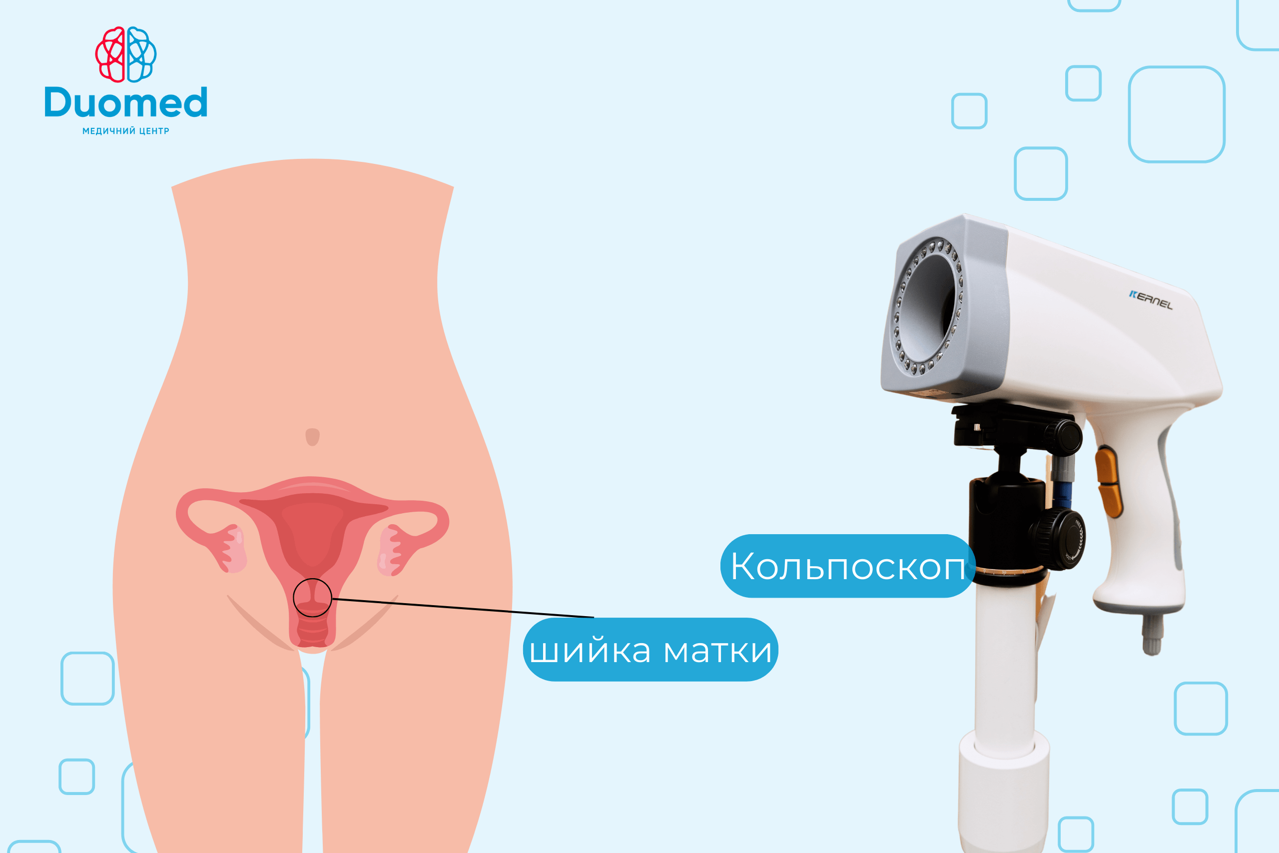 Біопсія шийки матки - image 2